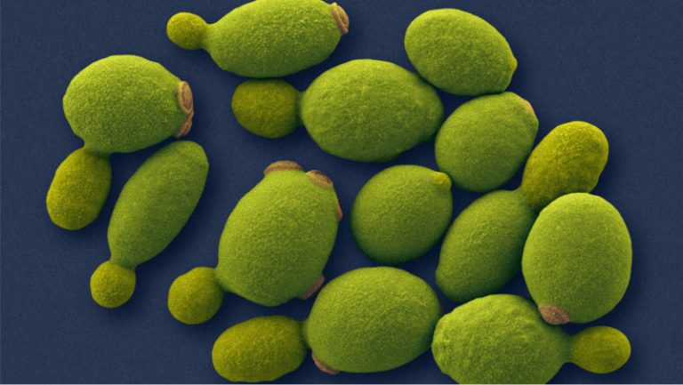Coloured SEM image of a group of yeast cells