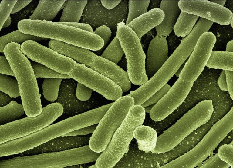 Electron micrograph of coliform bacteria.