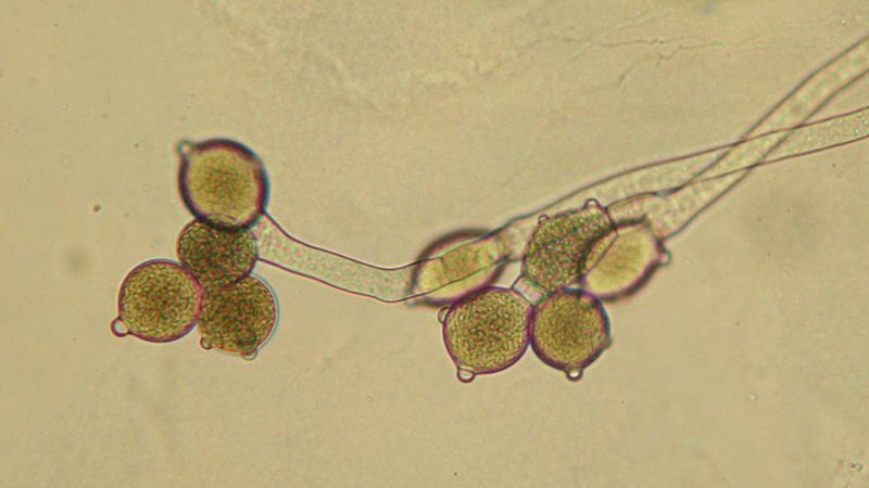 Allomyces sp. strain WJD103--zoosporangia of the sporophyte.