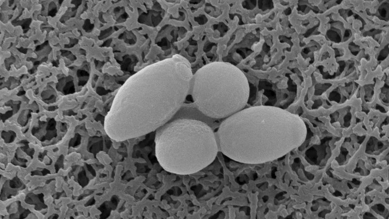 SEM micrograph of 4 yeast cells (Saccaromyces cerevisiae).